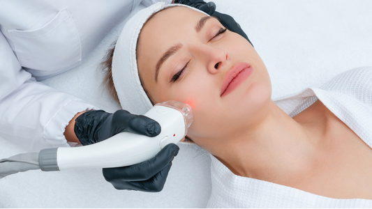 Laser Treatments for Skin: What to Know Before You Book- People Pleaser Co.