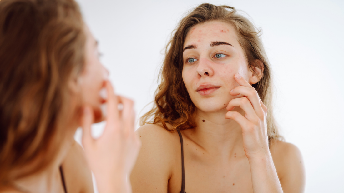 women looking in mirror with imperfect skin skincare routine not working