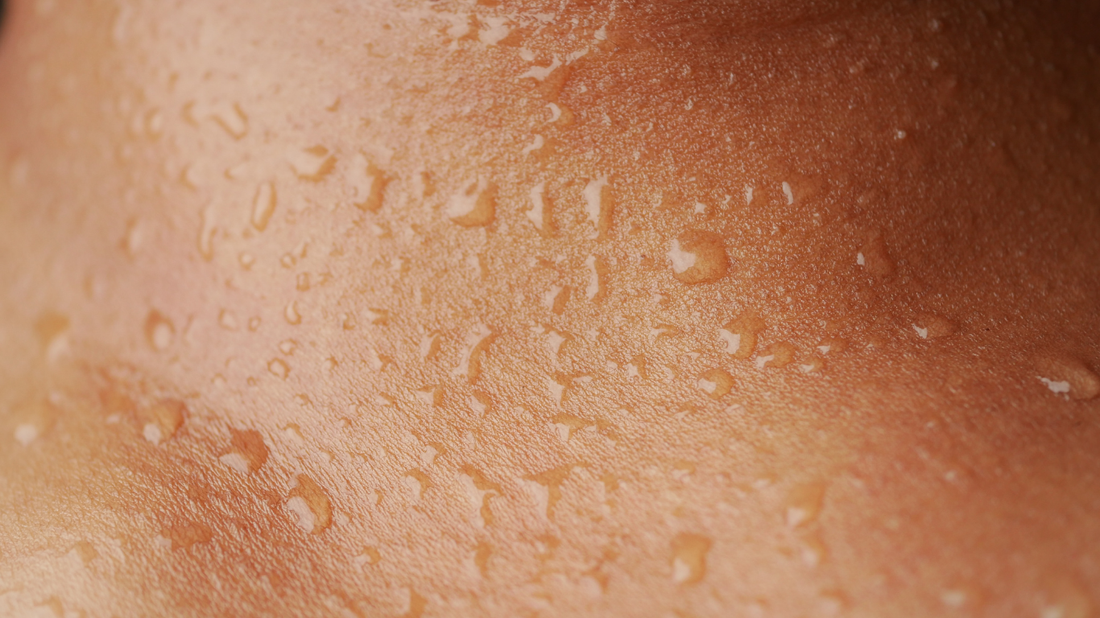 Hydrated skin with water droplets showing skincare hydration